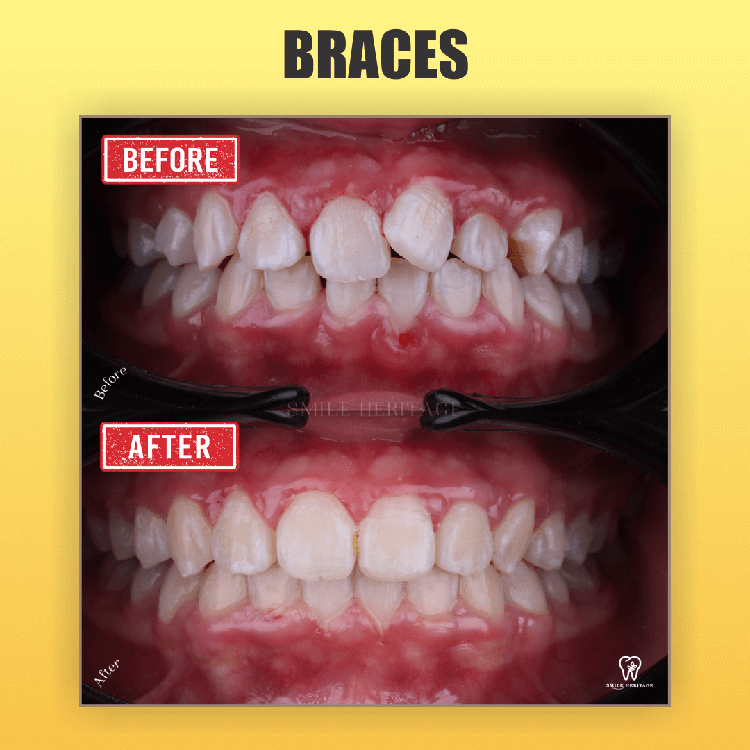 SMILE HERITAGE DENTAL CLINIC We Design Your Smile